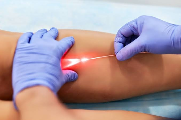Tratamento com Laser